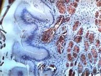 ScanStomachImmuno